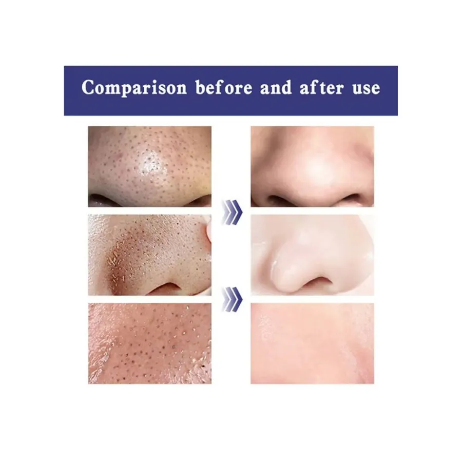 شرائط تنظيف المسام العميق للأنف بالفحم Lift &amp; Firm Original Deep Cleansing Pore Strips — 3