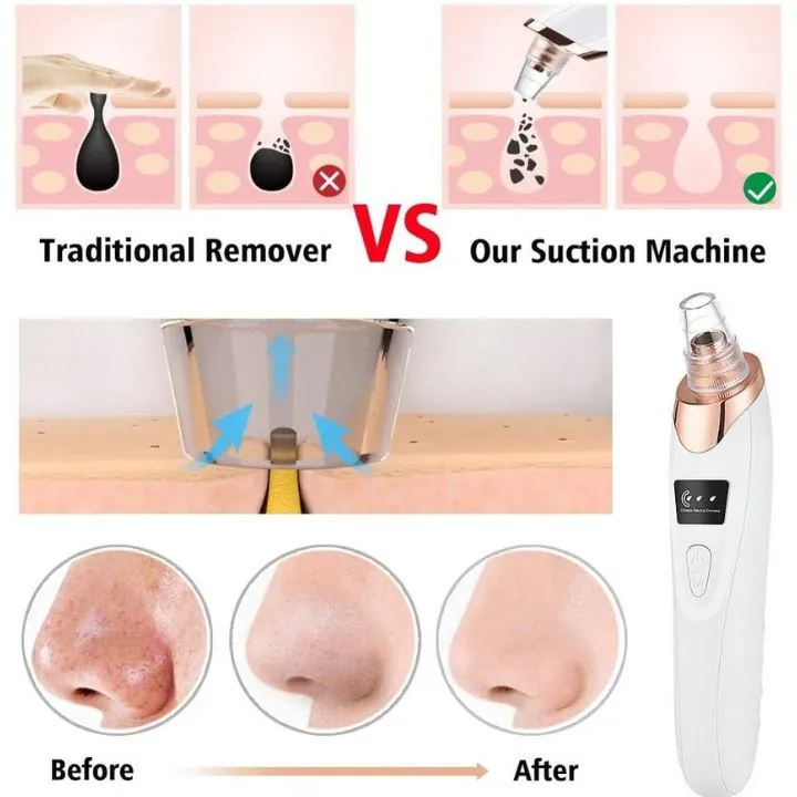 جهاز تنظيف الوجه متعدد الوظائف Multifunctional Cleaning Instrument — 5