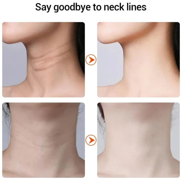 جهاز تجميل الرقبة وإزالة التجاعيد IPL Wrinkle Neck Beauty Device — 4