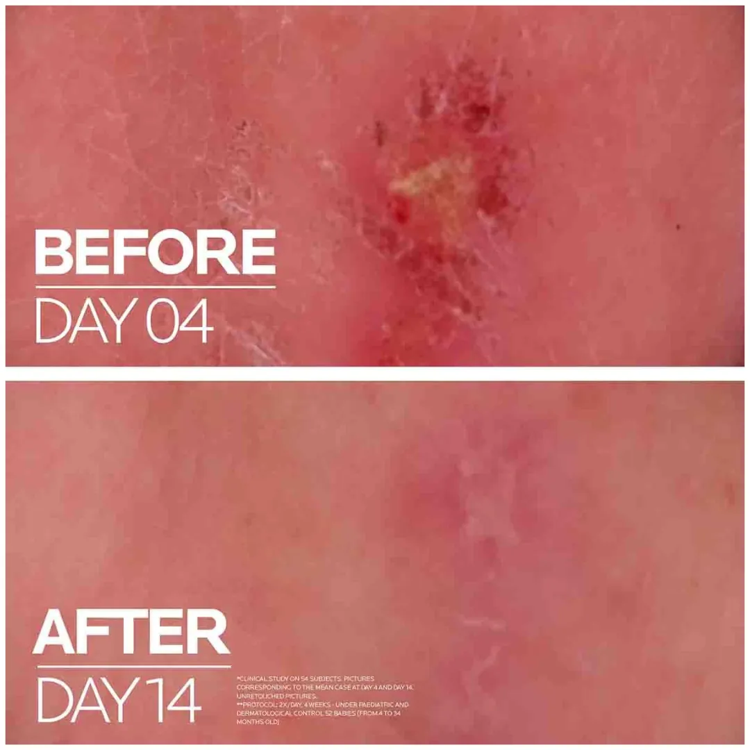 سيكابلاست بوم B5+ بلسم ترميم وتهدئة البشرة Cicaplast Baume B5+ — 3